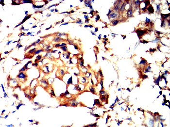 TLR8 Antibody