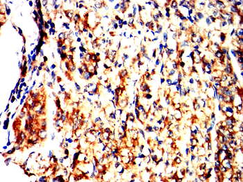 TLR8 Antibody