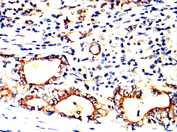 TLR8 Antibody