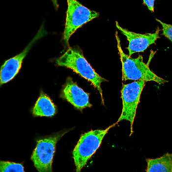 MB Antibody