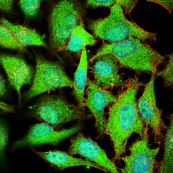 PIM1 Antibody