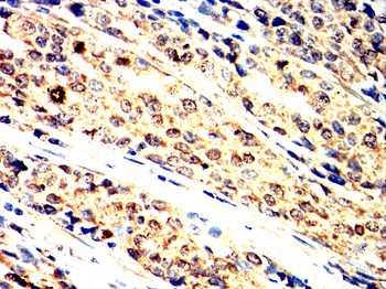 PIM1 Antibody