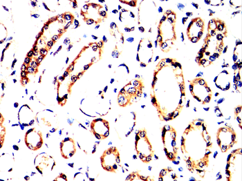 PIM1 Antibody