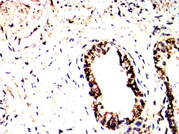 PIM1 Antibody