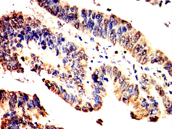 PIM1 Antibody