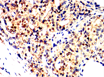 PIM1 Antibody