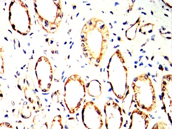 INSR Antibody