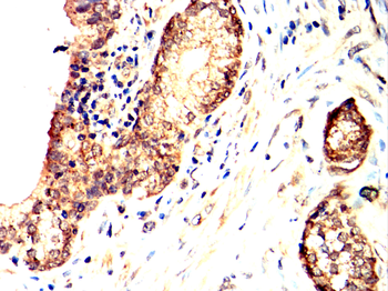 INSR Antibody