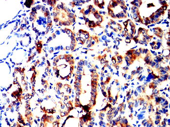 INSR Antibody