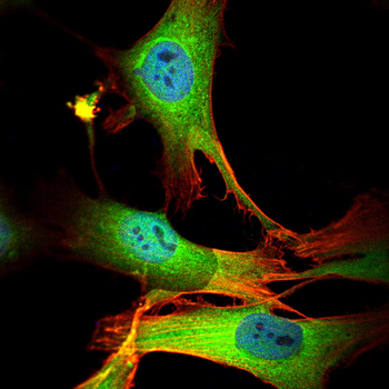 SMAD5 Antibody