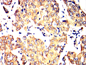 SMAD5 Antibody