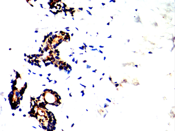 SMAD5 Antibody