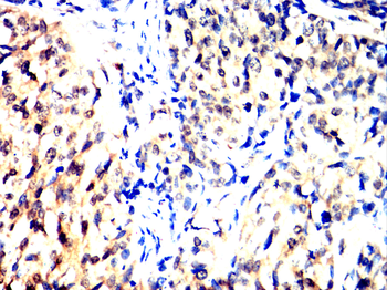SMAD5 Antibody