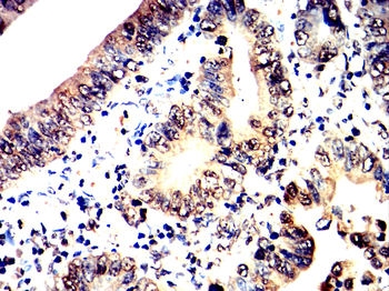 SMAD5 Antibody