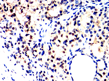 SMAD5 Antibody