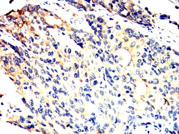 TNFRSF1B Antibody