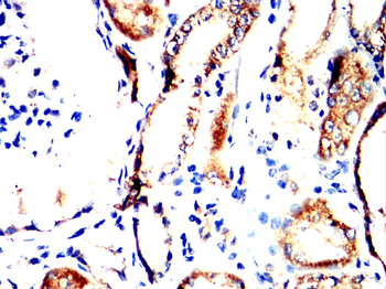 TNFRSF1B Antibody
