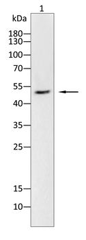 TNFRSF1B Antibody