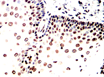 SATB2 Antibody