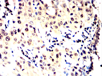 SATB2 Antibody