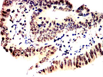 SATB2 Antibody