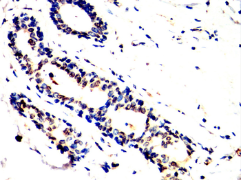 TBR1 Antibody