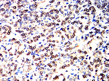 TBR1 Antibody