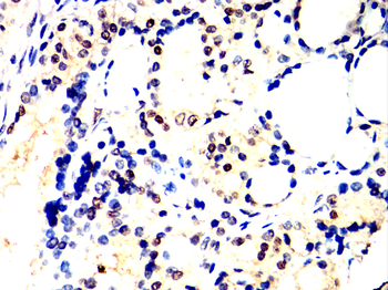 TBR1 Antibody