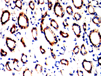 SMARCA4 Antibody