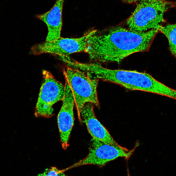 NGF Antibody