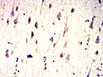 TH Antibody