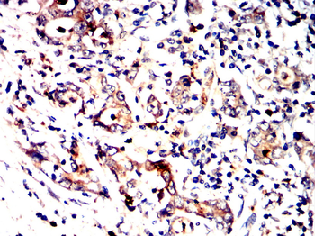 TH Antibody