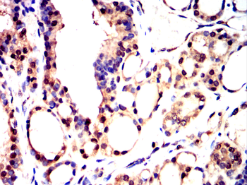 CEBPB Antibody