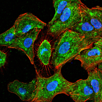 CEBPB Antibody
