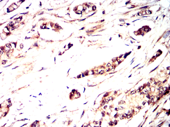 CEBPB Antibody