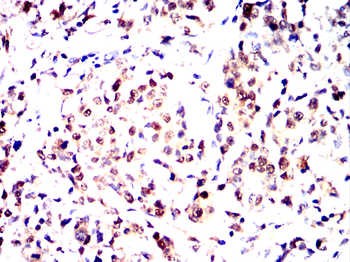 CEBPB Antibody