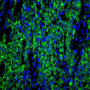 CEBPB Antibody