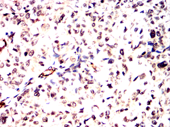 CEBPB Antibody