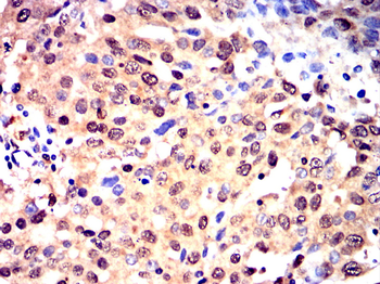 CEBPB Antibody