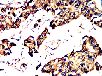 MAP3K3 Antibody