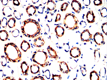 MAP3K3 Antibody