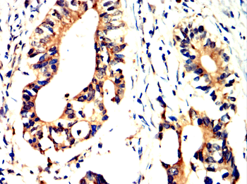 MAP3K3 Antibody