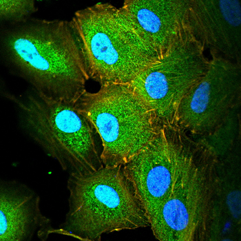 KRT13 Antibody