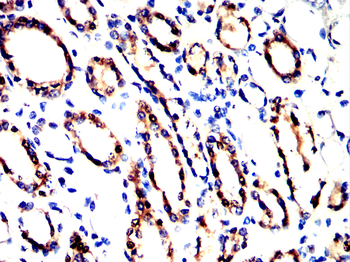 KRT13 Antibody