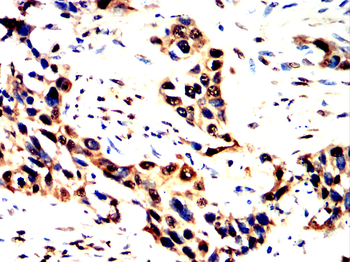 KRT13 Antibody