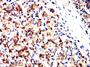 KRT13 Antibody