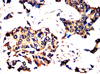 RET Antibody