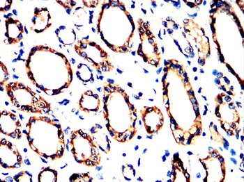 RET Antibody