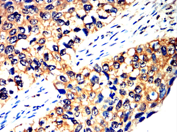 RET Antibody