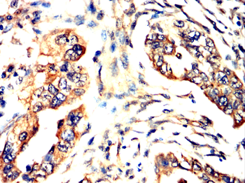 RET Antibody
